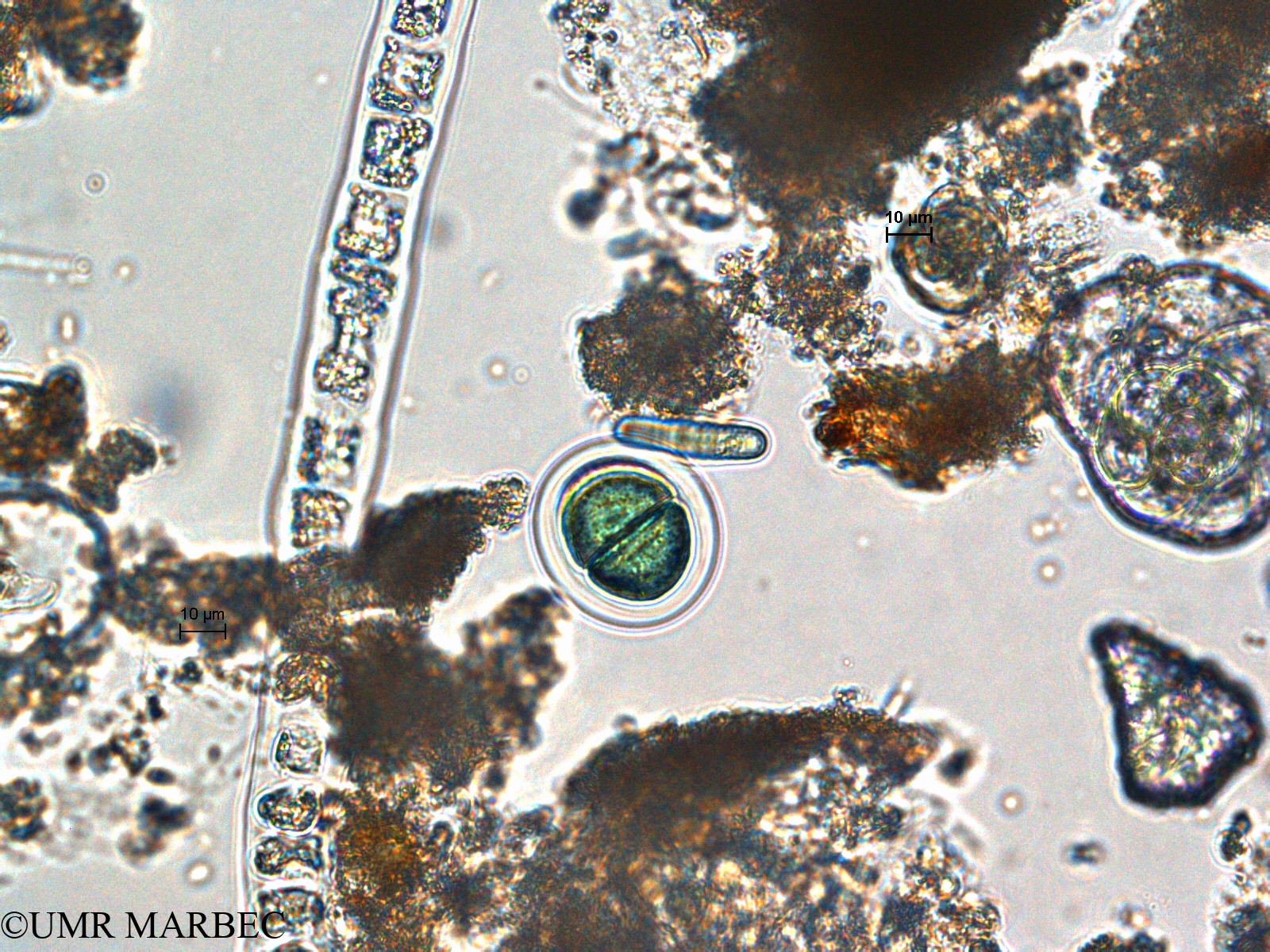 phyto/Scattered_Islands/europa/COMMA April 2011/Chroococcus sp4 (1)(copy).jpg